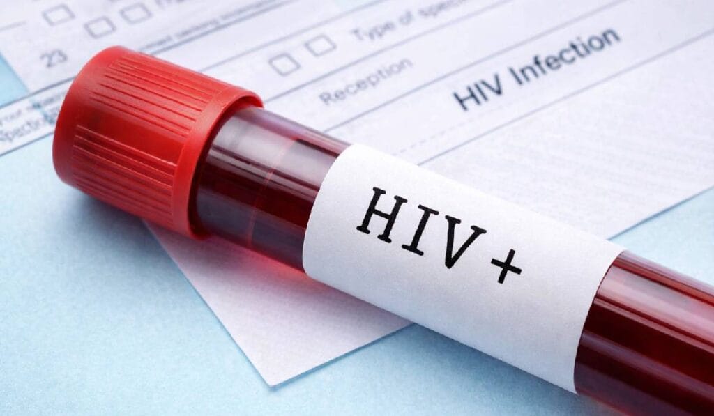 Chaibasa HIV+ Case