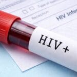 Chaibasa HIV+ Case