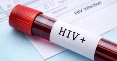 Chaibasa HIV+ Case